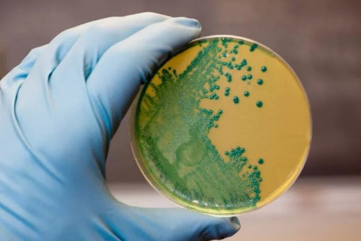 冰箱里李斯特菌是个啥 感染后症状有哪些