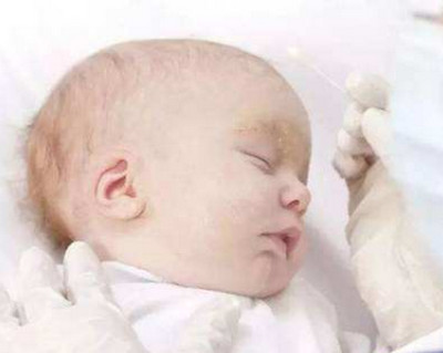 小baby胎毒是如何形成的
