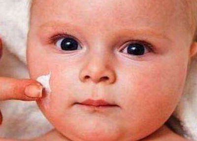 宝宝为什么长奶癣 怎么预防长奶癣