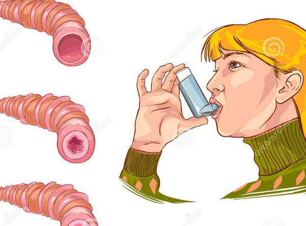 哮喘病不能吃什么 哮喘要注意些什么