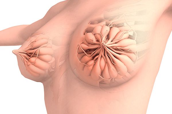 乳腺癌早期症状 乳腺癌有哪些早期症状