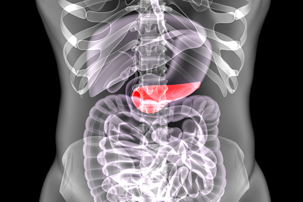 胰腺癌的早期症状 胰腺癌早期有什么症状表现