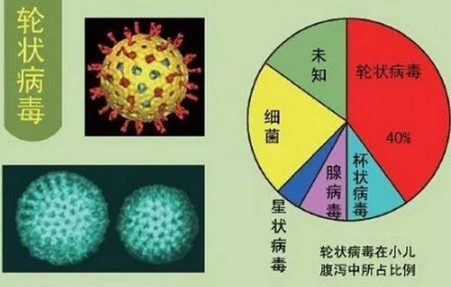 什么是儿童轮状病毒腹泻 得了秋季腹泻该咋办