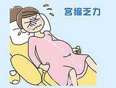 宫缩乏力怎么注意 如何处理