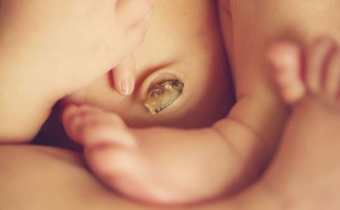 新生儿脐带出血怎么办 脐带护理要注意什么