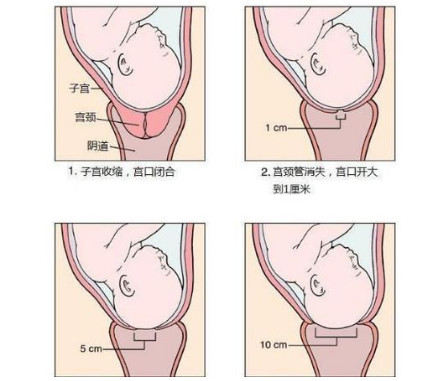 什么是开十指 生孩子时说的开指是什么意思